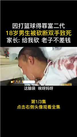 因打篮球得罪富二代，18岁少年被砍断双手离世，家长给我砍，老子有钱 (1)
